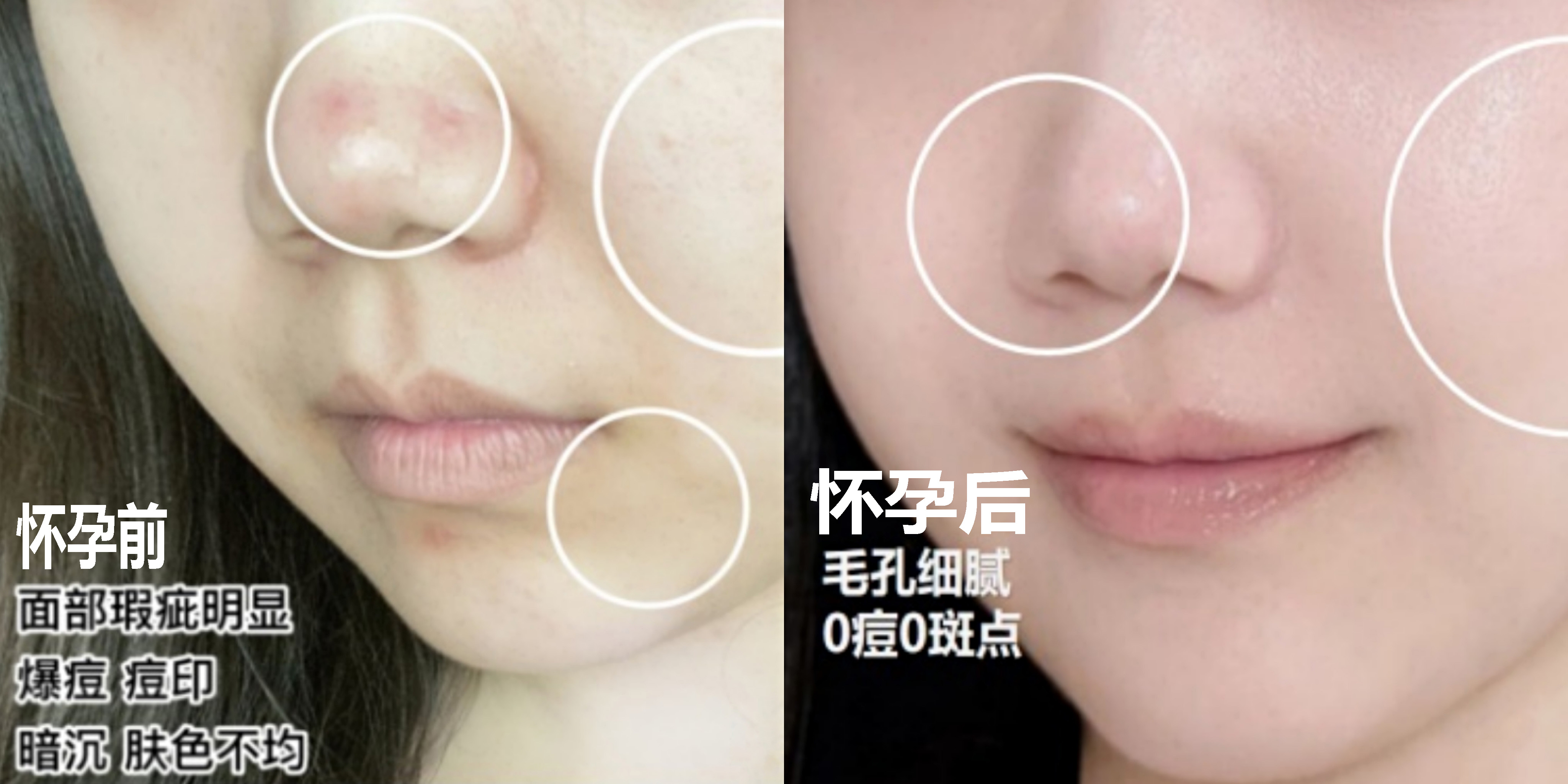 护肤品 孕期如何拯救“烂脸”？4款平价好用的“老牌护肤品”，值得入手