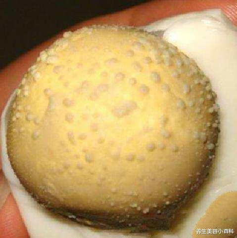 鸡蛋|几个鸡蛋减轻你身上的湿气, 让你一身轻松、更健康!