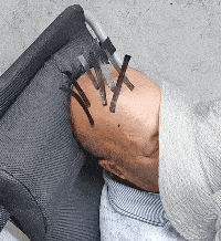 孙俪|孙俪近照引争议!眼凸脖颈鼓包,无效养生被指像青蛙