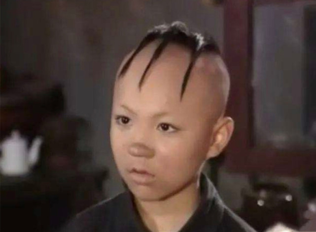 孟智超|《三毛流浪记》“三毛”长大了！8岁成名，14岁秃顶，植发挨300多针