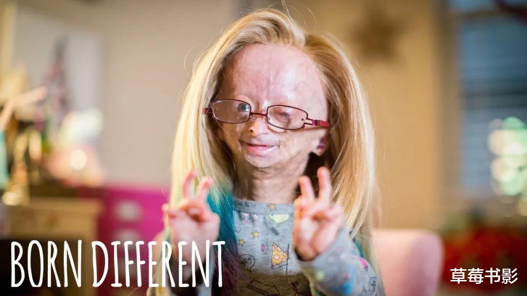 早衰症|患早衰症15岁千万粉丝少女博主逝世，粉丝：她终于不再痛苦了