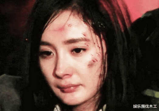 杨幂|杨幂眼伤后续!《密4》上线受伤镜头一剪梅,节目掩盖隐患未表态