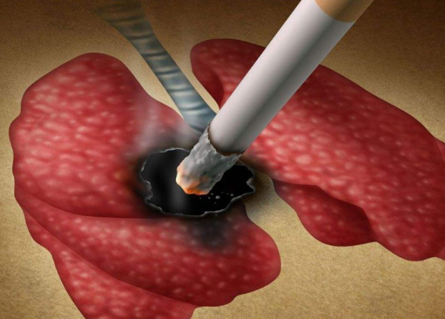 脾胃|它比香烟“毒性”强7倍，可能只有中国人还拿它当宝，多国已抵制