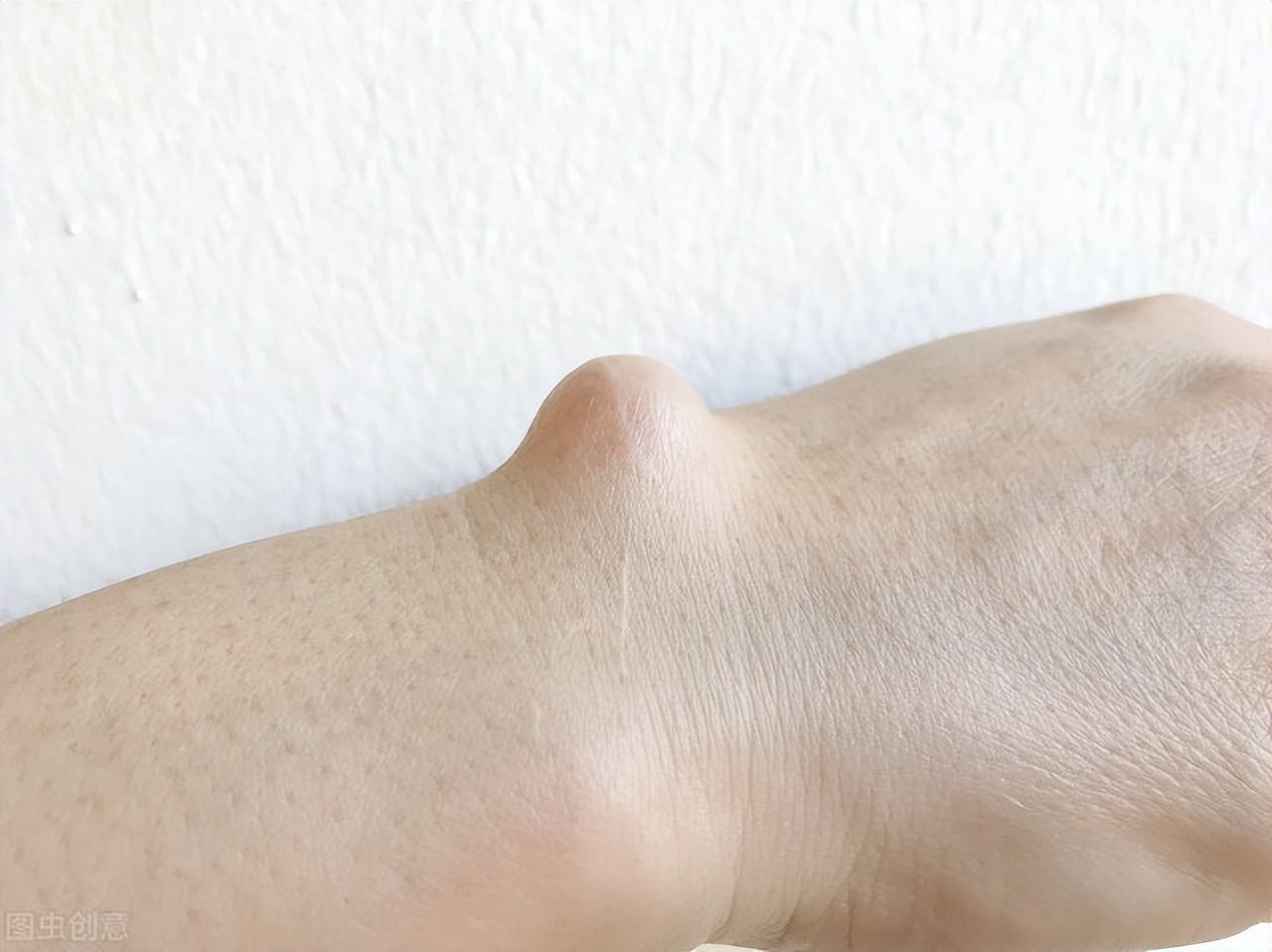 医生|结节、囊肿多因肝气郁结，一个方子，疏肝解郁、横扫结节、囊肿