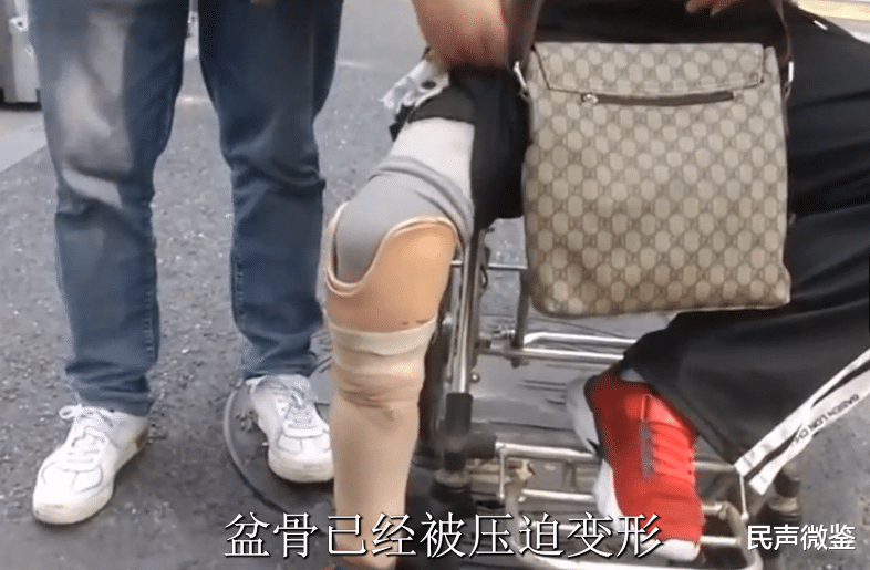 捐给孩子70万治病钱,却被基金会霸占不给,难道善款被“吞”了吗