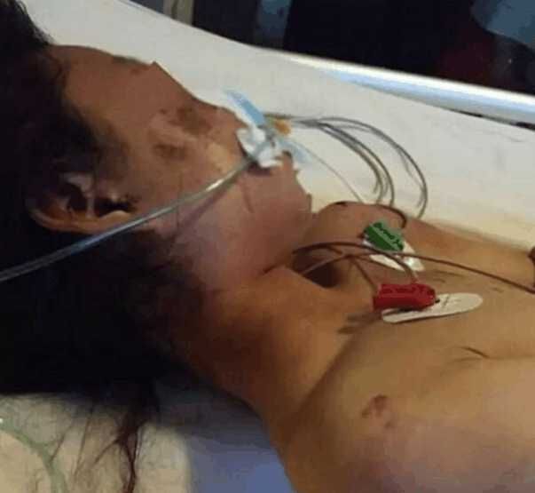 13岁女孩家中睡觉, 陌生男子闯入打昏实施侵犯, 女孩: 很疼