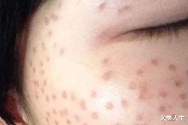 黑色素 去年美白又翻车了?点进来补课!