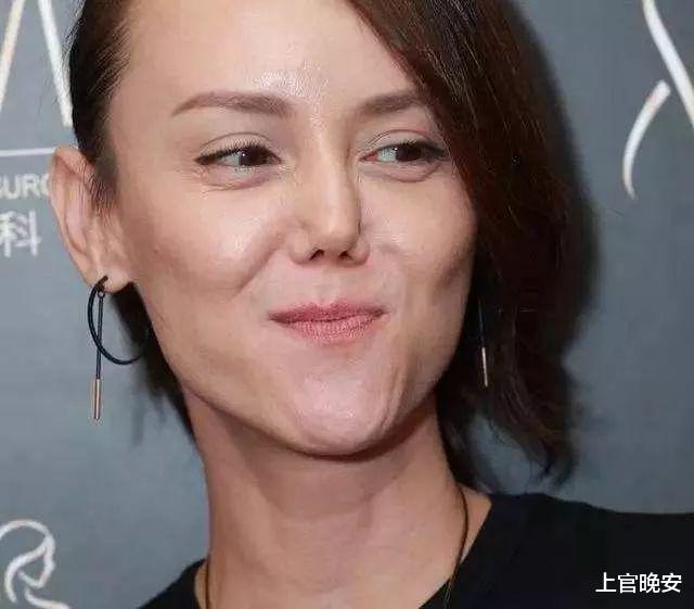 娱乐圈|娱乐圈明星们的假鼻子，真的绝了！都是狠人