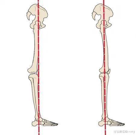 失眠|腿不直，小腿还粗？你可能存在这种体态，这6个动作要经常练！