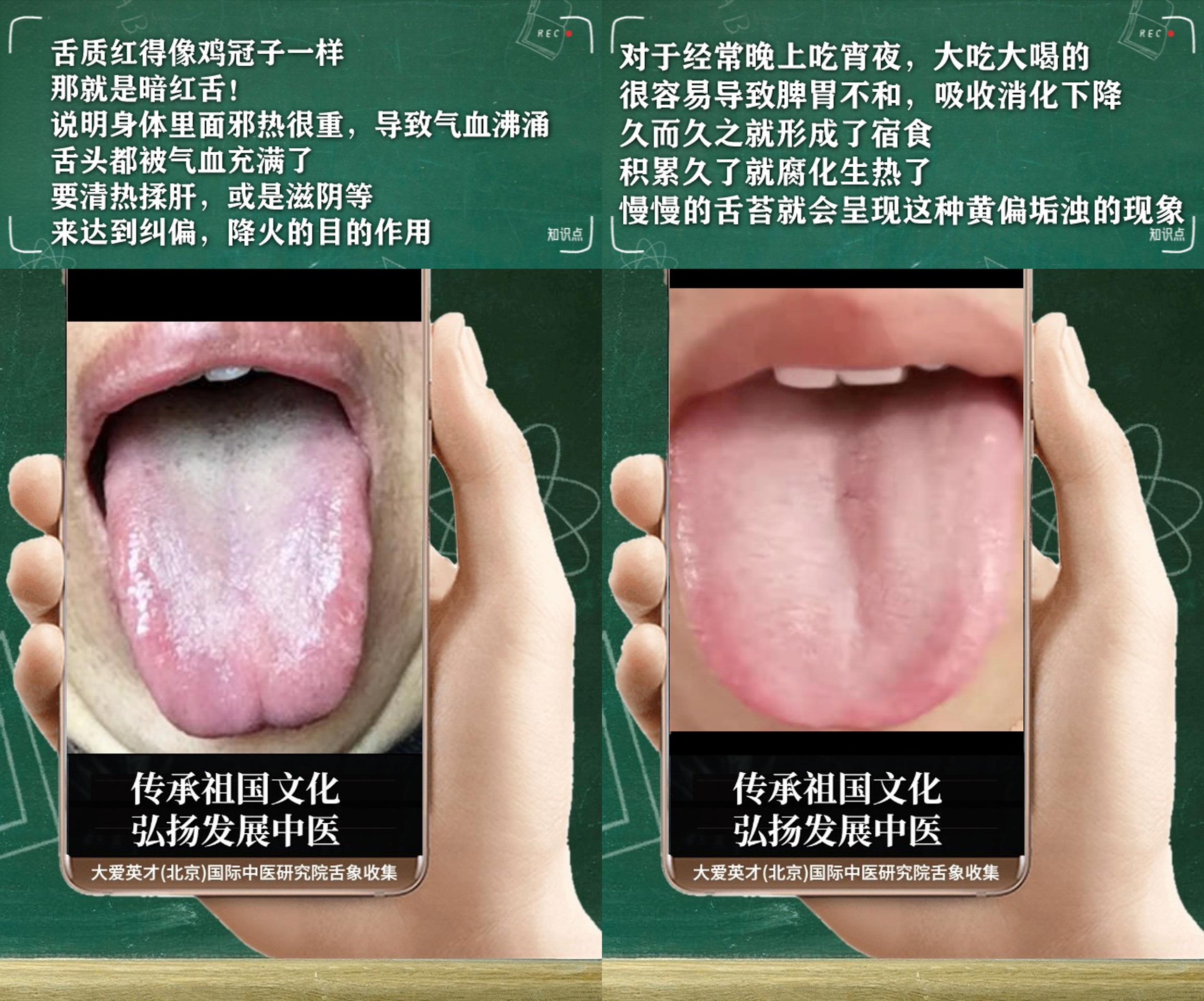 失眠|中医医案：反复胃痛，胸闷，心烦失眠，排便无力，记忆力下降