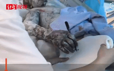 患癌妻子临终被逼打胎,丈夫一句话惹怒朋友圈:嫁错人,真的会要命