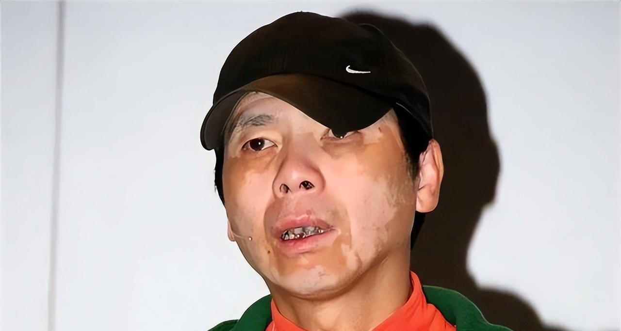 李宇春|“被病魔缠身”的6位明星，明明一个比一个有钱，却依旧有口难言