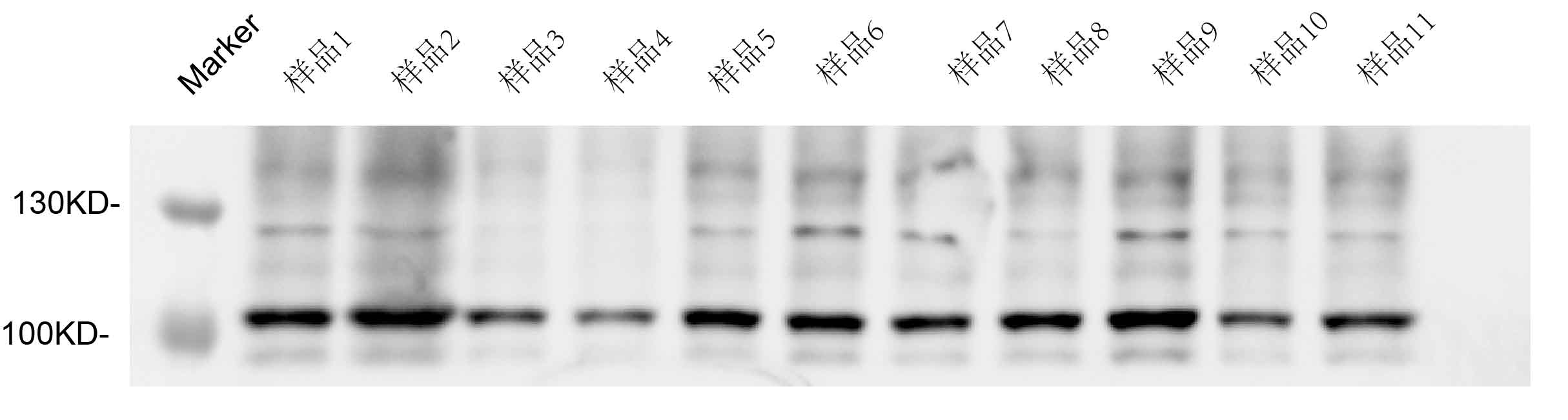WB蛋白质印迹法(Western blot)