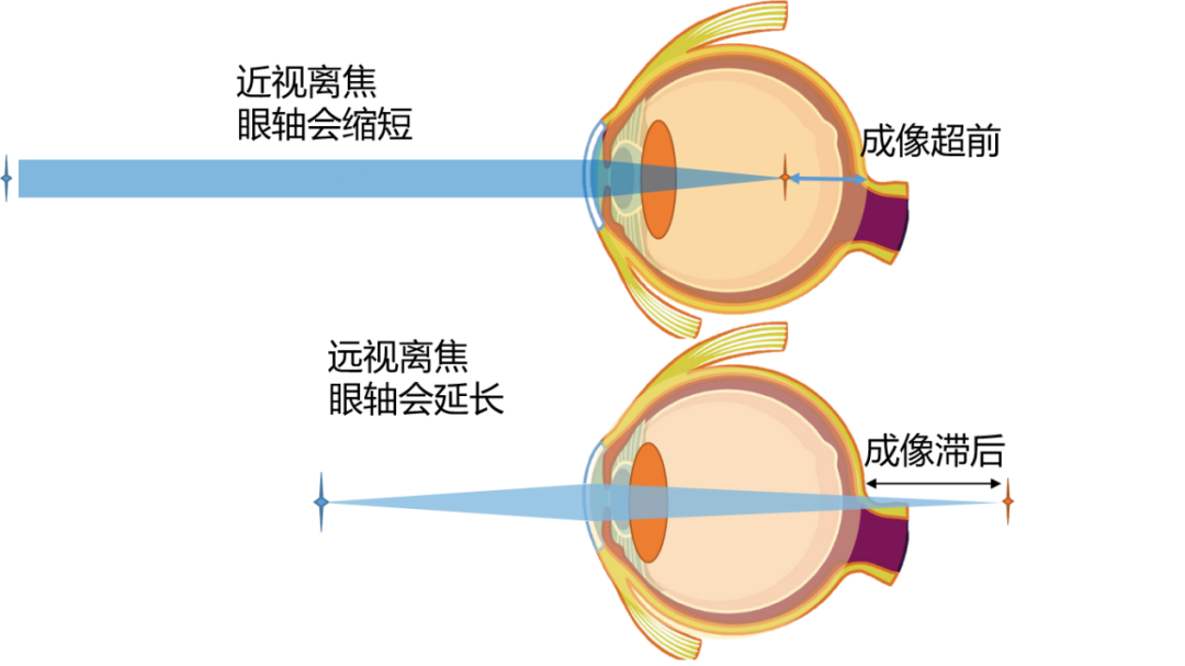 山药|什么时候需要训练调节力?