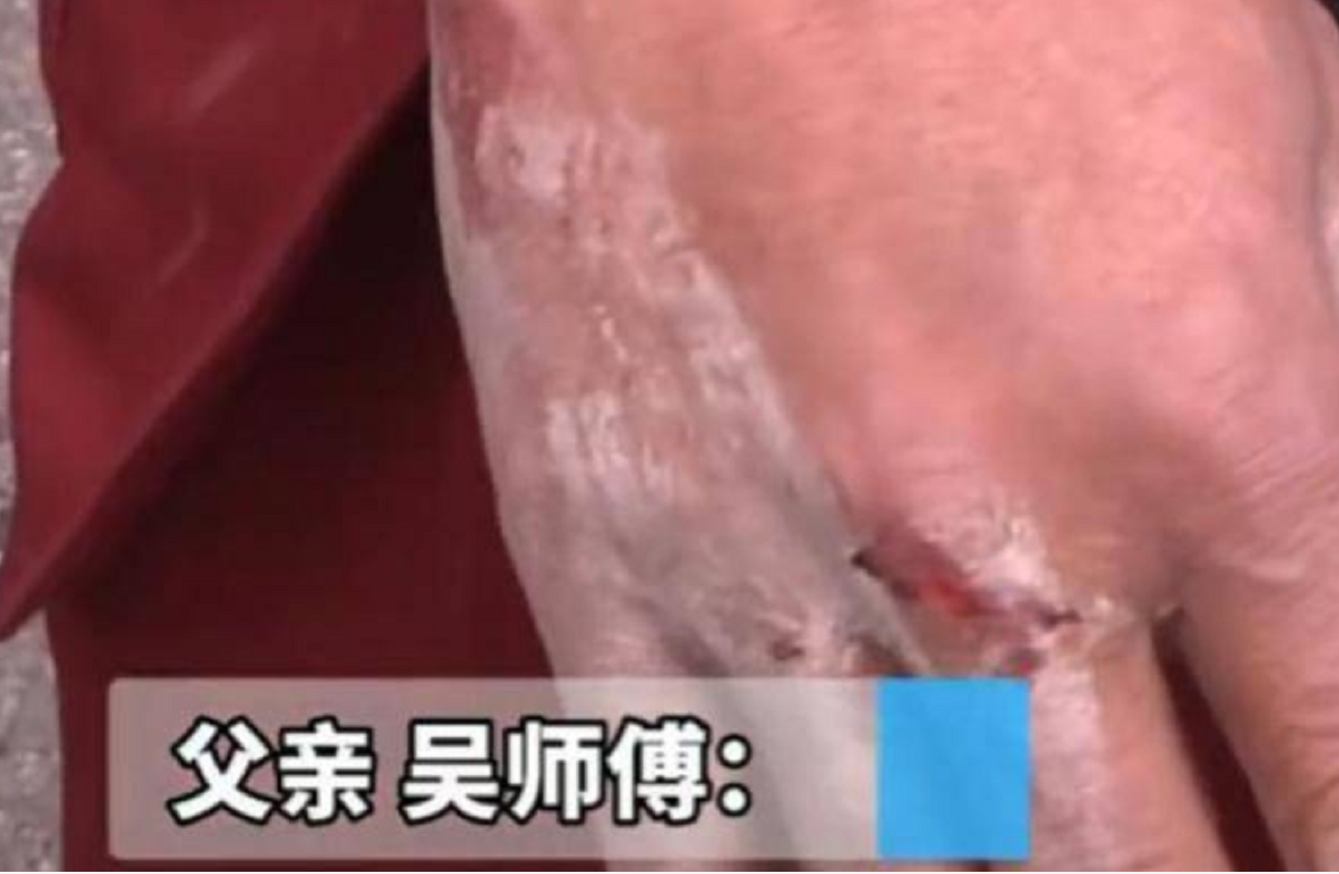 16岁女孩网恋27岁男友, 家中私会意外被父亲撞破, 父亲反遭男友毒打