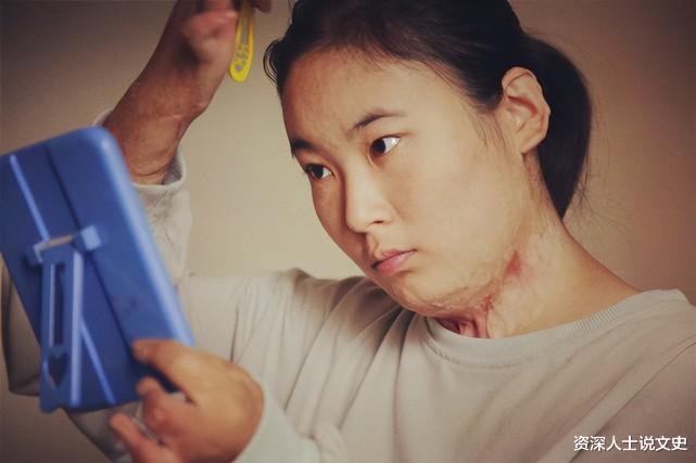 2018年姐姐被烧伤毁容,弟弟:姐,没人娶你,我养你一辈子