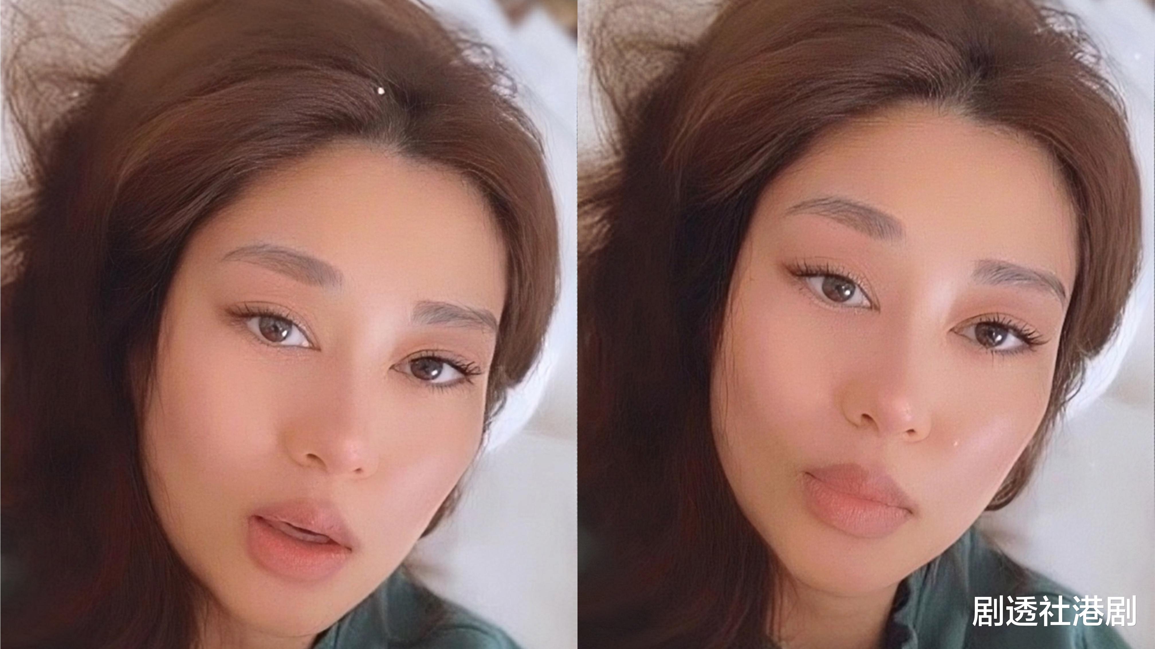 整容|香港知名女星再陷整容疑云!嘴唇像打了丰唇针,网友:老了20岁