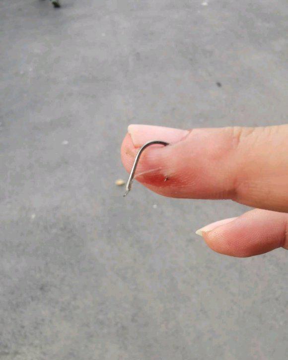 |盘点钓鱼人各种花式钓自己，看着就很疼！预防和处理方法分享