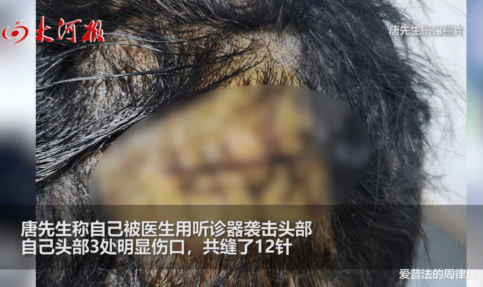 男子高烧排队两小时,因错过叫号被拒诊,与医生产生冲突后被打!