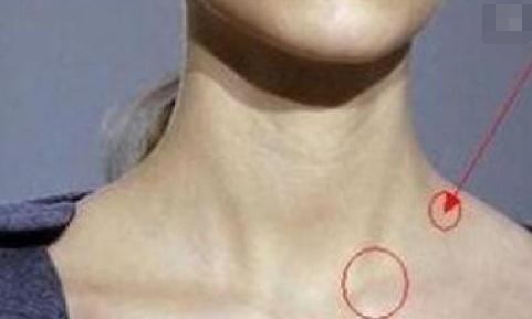 淋巴癌|“淋巴癌”接近时,身体可能亮出3个“信号”,可惜大多人忽略了