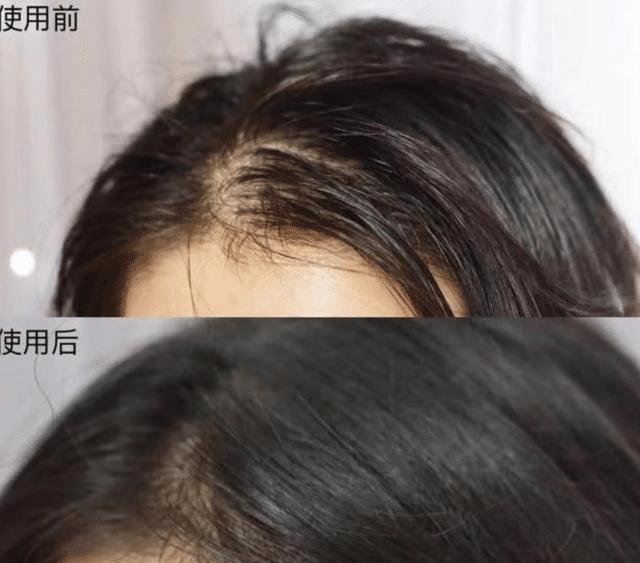 洗发水 央视曝光，建议“不要买”这四种洗发水，尽管是老品牌但存在许多问题