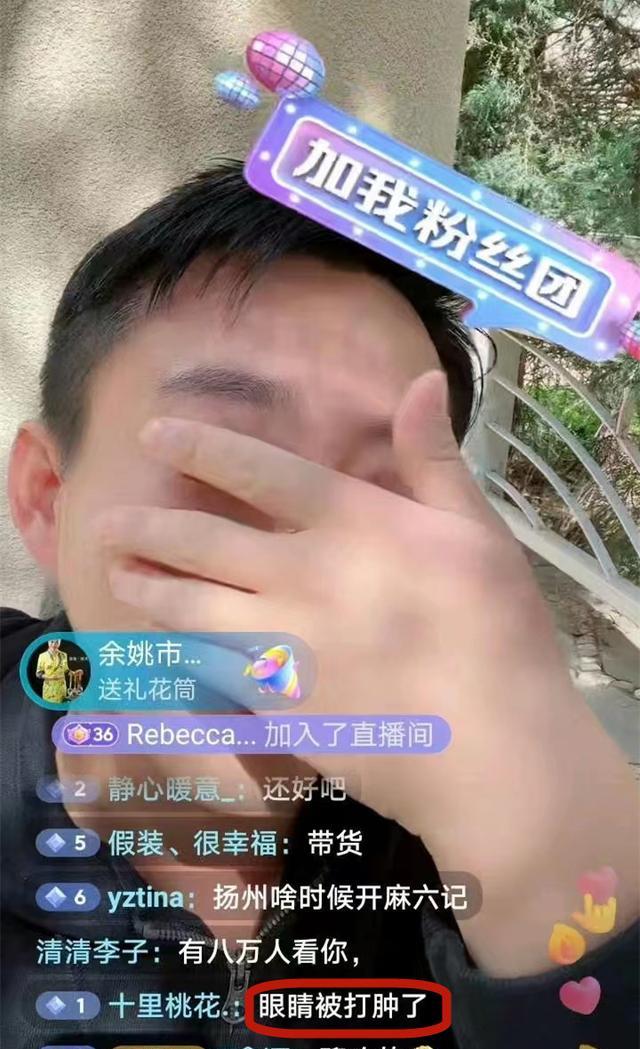 汪小菲|网曝汪小菲被打，脑袋受伤血流不止，网友：活该