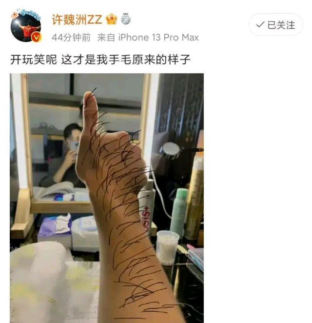 官宣|许魏洲正式官宣结婚，为爱刮了手毛？彭昱畅：果然还是你快一步