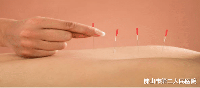 拔罐|知道吗，痛风除了吃降尿酸药，还可试试针灸拔罐刮痧