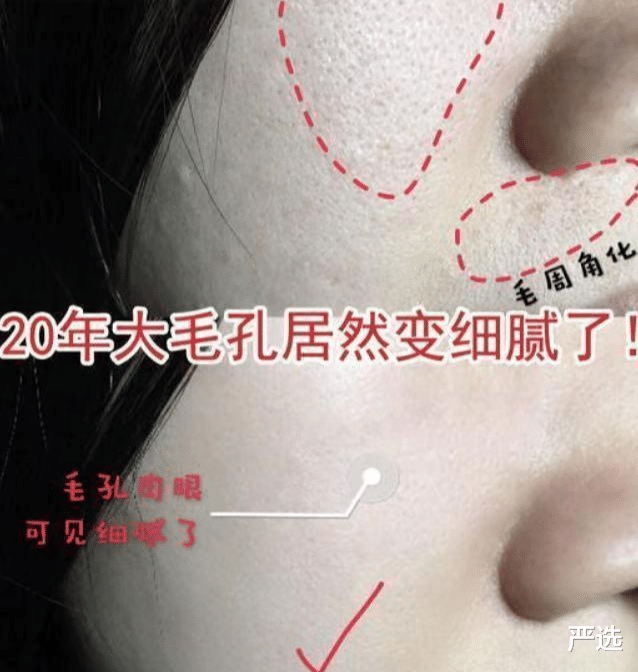 何超琼|姜文、于正拿她没辙,暴起来整个娱乐圈陪她炸!却为美容受900针