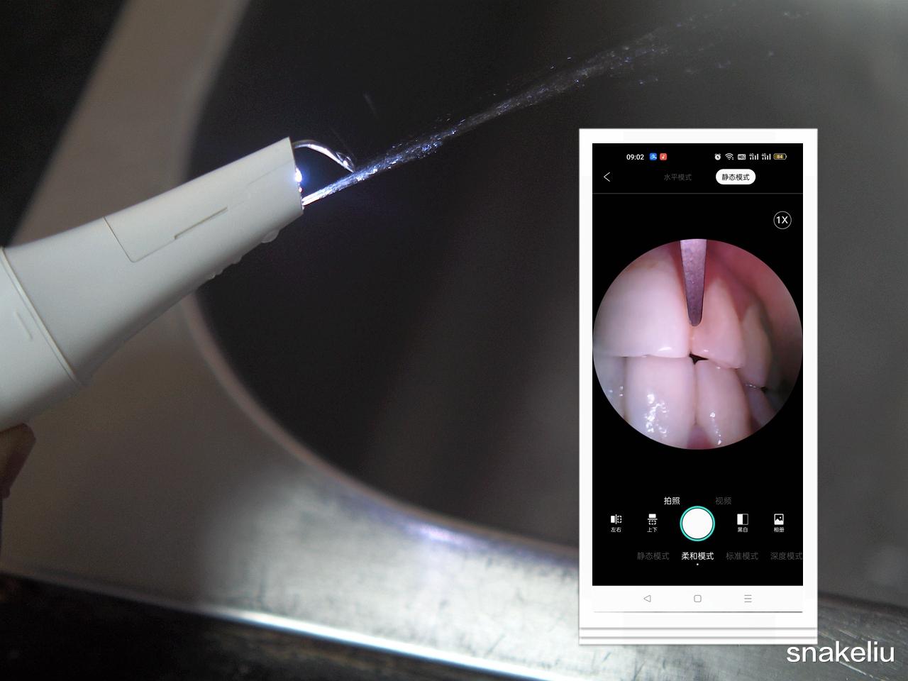 洁牙|医院洁牙太贵还要预约 素诺可视化洁牙自己在家就可以洁牙