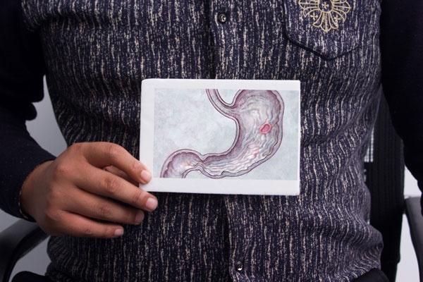 胃癌|胃病患者,若是这个时间点胃胀,可能是胃癌前兆