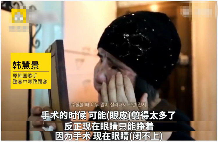 韩慧景|痴迷整容15年,把脸整成“电风扇”后遗症明显,韩慧景后悔了吗?