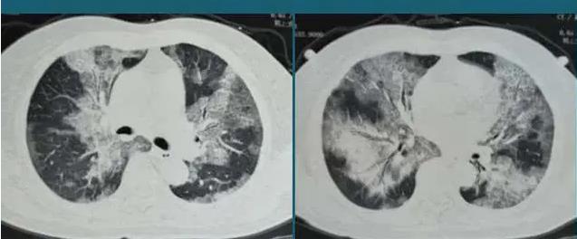钟南山|疫情全面放开后,钟南山院士却总被攻击,啥原因让84老者晚节不保