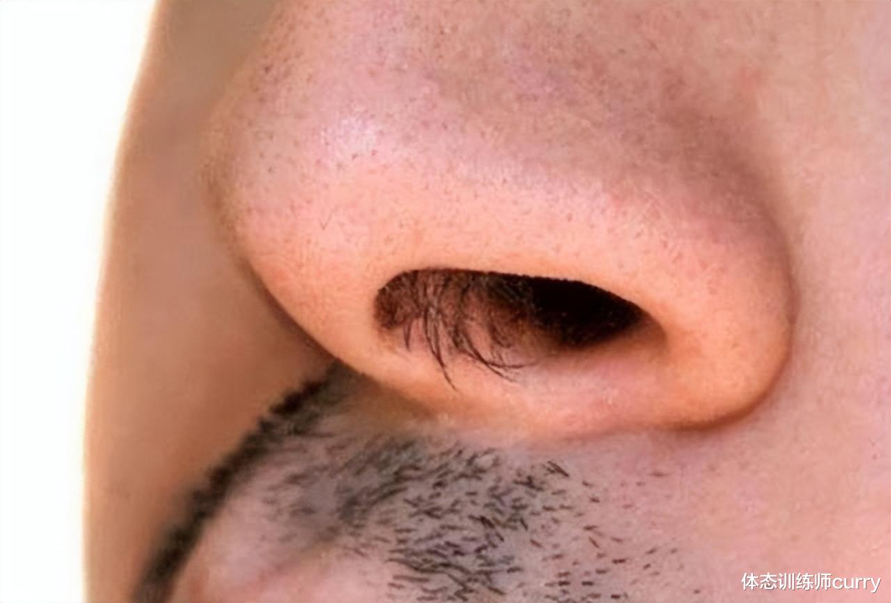 脑卒中|鼻毛“往外窜”的男人，有何不同之处？鼻毛旺盛说明什么？早了解