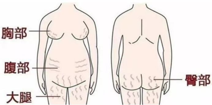 孕期肚子突然爆发3信号,孕妈需警惕!掌握2个妙招,拥有小白肚