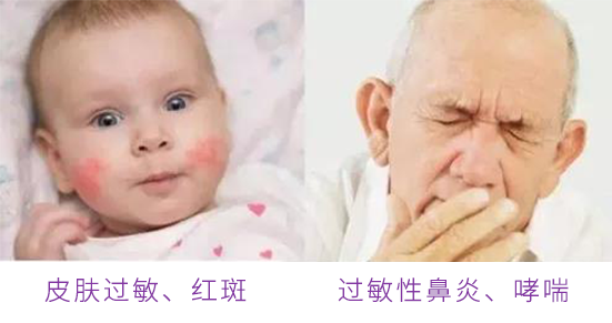 家里这3样东西,看似干净实际却比马桶还“脏”!基本每家都中招