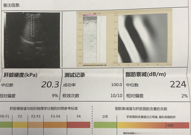 乙肝|乙肝“金字塔”，你在第几层？