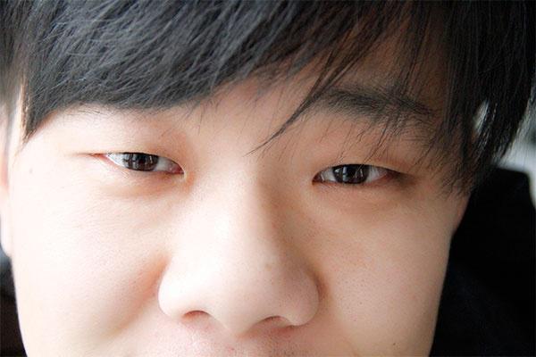 银屑病|从脸看健康,退休老中医:若脸色没出现五种表现,说明身体还不错