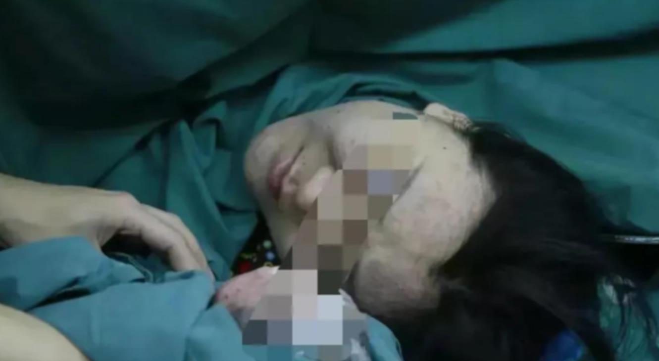 外婆的子宫孕育外孙!2015年,女子移植母亲子宫,4年后生下男婴
