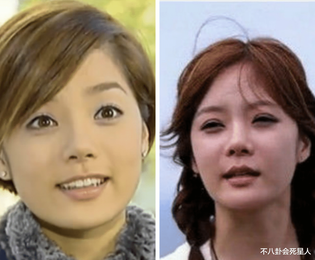 整容|那些红极一时的韩流明星，整容整得面目全非，动脸后遗症太可怕