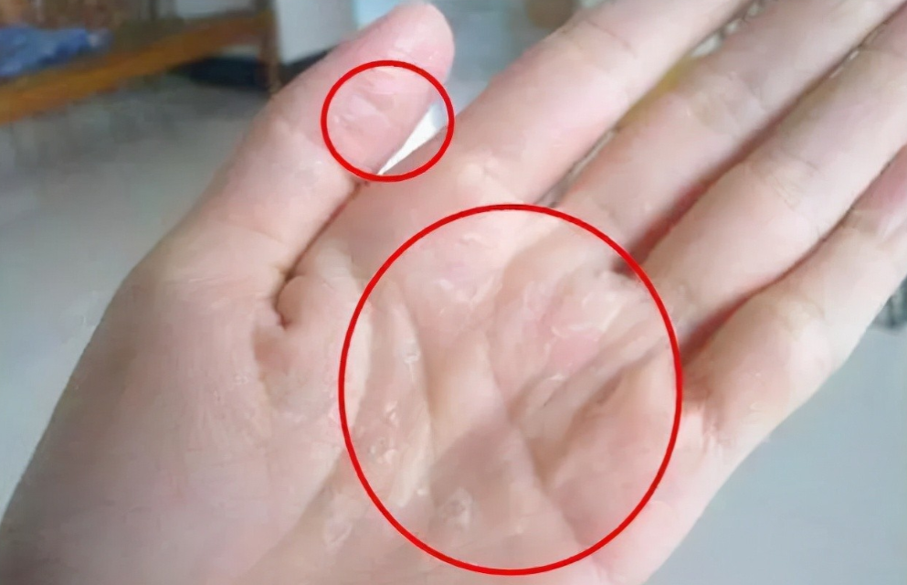 若再装修,油烟机一定坚持“5不要”!不是误导,而是经验之谈