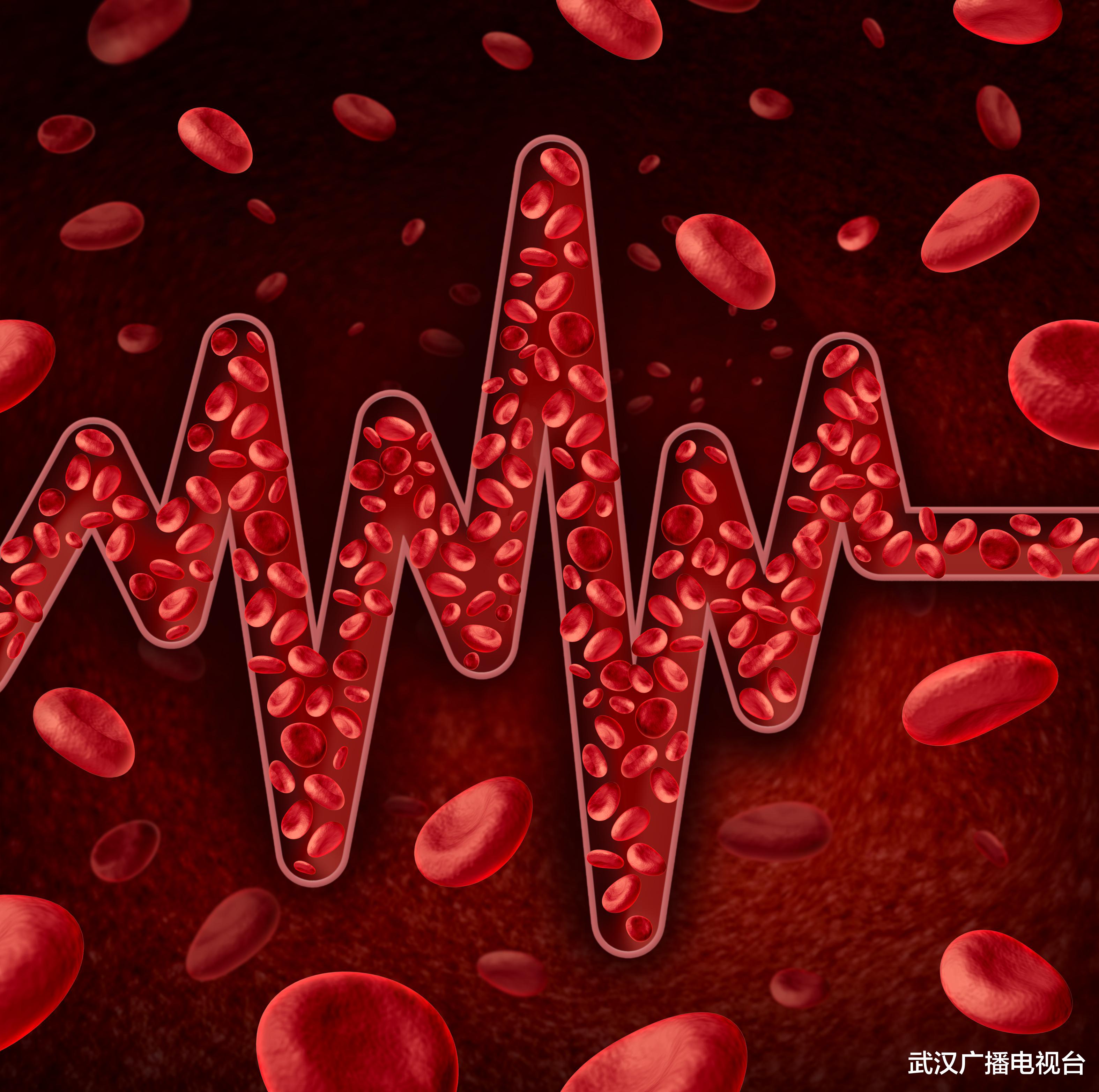 中风|30岁女子突发中风 竟是心脏上比别人多个“洞”