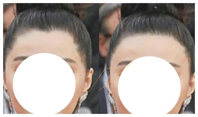 发际线|朴敏英新剧《月水金火木土》,这个发际线好像戴了个假头套?