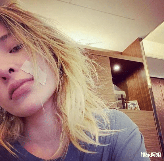 萧亚轩|萧亚轩素颜直播公开右脸伤疤,脸部消瘦显憔悴,但美貌依然在线