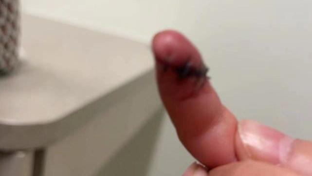 张恒|张恒曝郑爽疑似美国虐童，美国律师：如照片真实可剥夺女方抚养权！