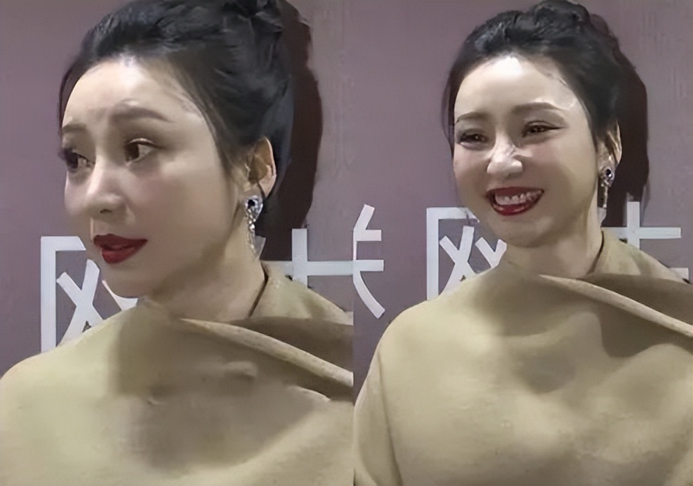 整容|年纪轻轻就眼歪嘴斜的5位明星，有的是天生遗传，有的是整容过度