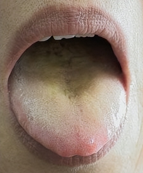 更年期|腰疼别大意!可能是因为这5个原因,学会不走弯路