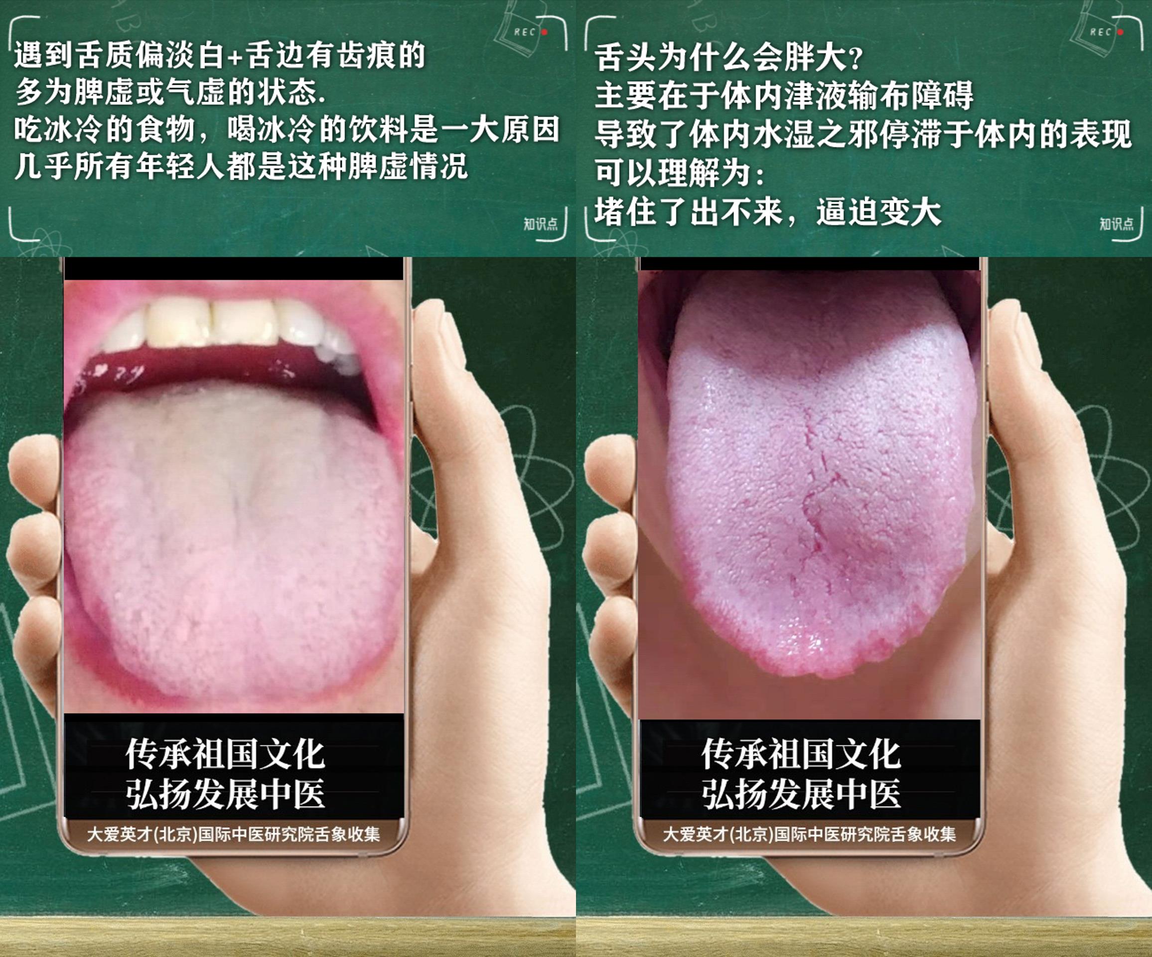 穴位|中医分析:很烦躁,腰膝酸软,鼻子不通,一直反复很烦躁