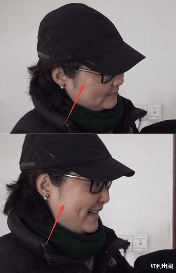 鹤唳华亭|49岁袁立到县里医院探病，近照曝光肿一圈，脸上白斑突出引人担忧