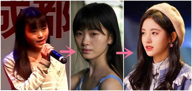 整容|长得“歪瓜裂枣”,整得“如花似玉”,这些女星都靠脸逆天改命